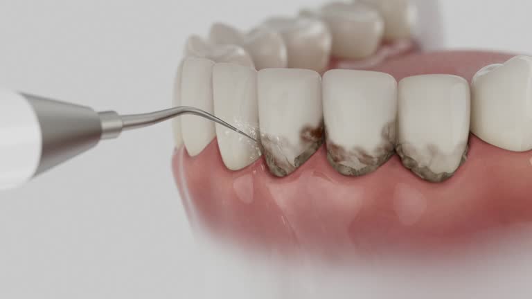 Trusted Wisdom Tooth Removal service in North Prairie, WI - Dentist Open Now